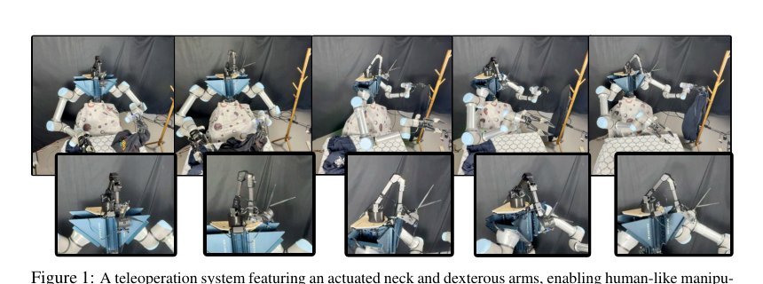 Learning to Look Around: Enhancing Teleoperation and Learning with a Human-like Actuated Neck Figure 1