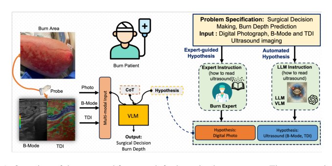 Vision-Language Reasoning for Burn Depth Assessment with Structured Diagnostic Hypotheses Figure 1