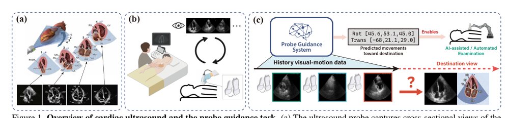 EchoWorld: Learning Motion-Aware World Models for Echocardiography Probe Guidance Figure 1
