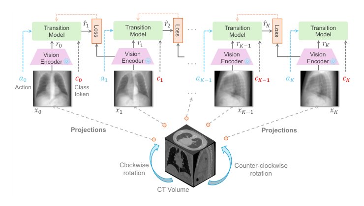 Xray2Xray: World Model from Chest X-rays with Volumetric Context Figure 1