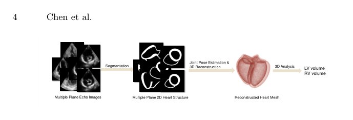 3D Heart Reconstruction from Sparse Pose-agnostic 2D Echocardiographic Slices Figure 1