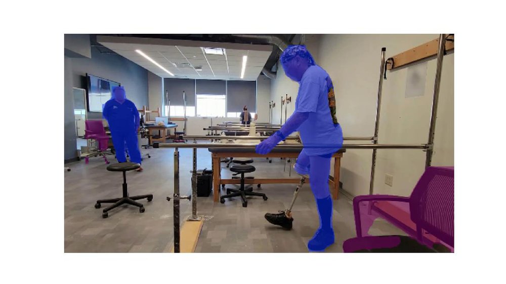 ProGait: A Multi-Purpose Video Dataset and Benchmark for Transfemoral Prosthesis Users Figure 1