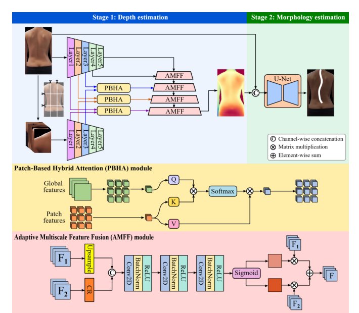 A Dual-Feature Extractor Framework for Accurate Back Depth and Spine Morphology Estimation from Monocular RGB Images Figure 1