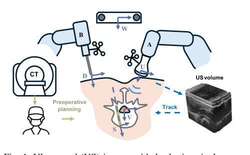 Robust-Sub-Gaussian Model Predictive Control for Safe Ultrasound-Image-Guided Robotic Spinal Surgery Figure 1