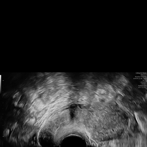 From Slices to Structures: Unsupervised 3D Reconstruction of Female Pelvic Anatomy from Freehand Transvaginal Ultrasound Figure 1