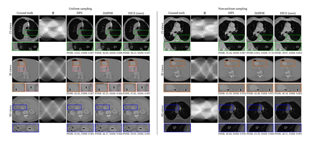 DICE: Diffusion Consensus Equilibrium for Sparse-view CT Reconstruction Figure 1