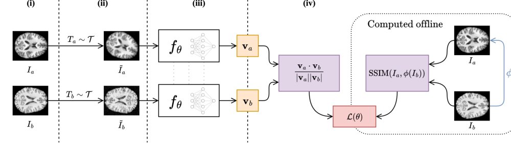 A Novel Metric for Detecting Memorization in Generative Models for Brain MRI Synthesis Figure 1