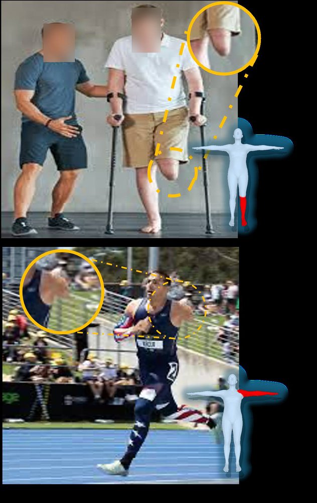 AJAHR: Amputated Joint Aware 3D Human Mesh Recovery Figure 1