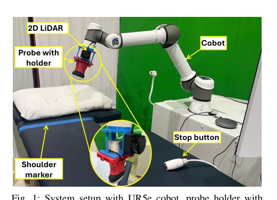 Finding an Initial Probe Pose in Teleoperated Robotic Echocardiography via 2D LiDAR-Based 3D Reconstruction Figure 1