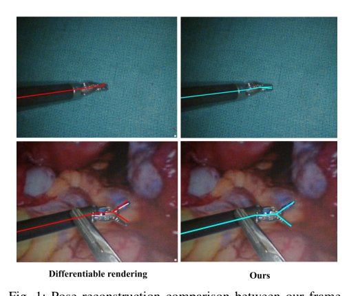 Efficient Surgical Robotic Instrument Pose Reconstruction in Real World Conditions Using Unified Feature Detection Figure 1