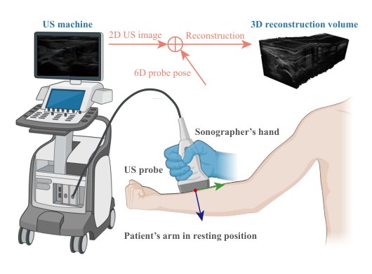 Freehand 3D Ultrasound Imaging: Sim-in-the-Loop Probe Pose Optimization via Visual Servoing Figure 1