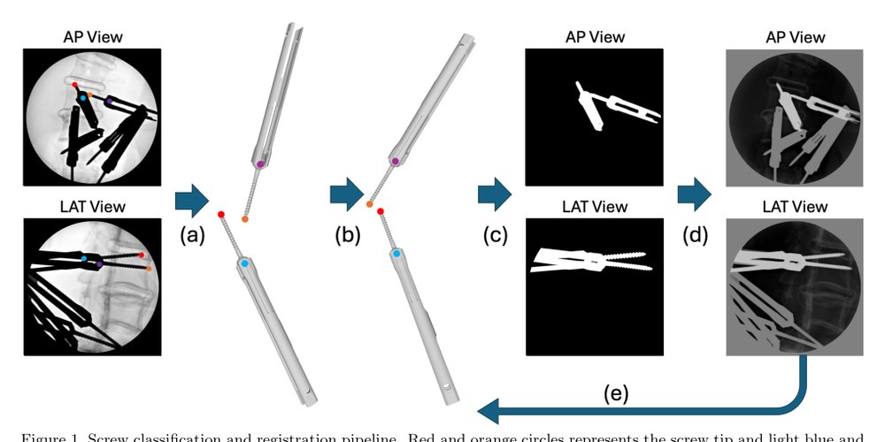 Pedicle Screw Pairing and Registration for Screw Pose Estimation from Dual C-arm Images Using CAD Models Figure 1