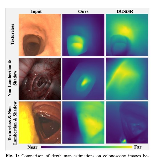 ColonAdapter: Geometry Estimation Through Foundation Model Adaptation for Colonoscopy Figure 1