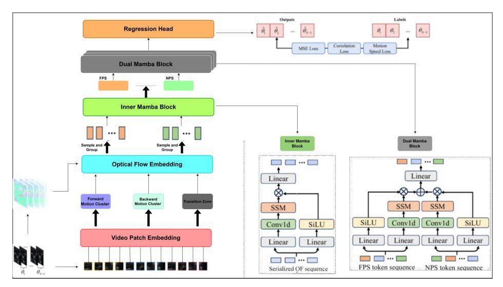 UltrasODM: A Dual Stream Optical Flow Mamba Network for 3D Freehand Ultrasound Reconstruction Figure 1
