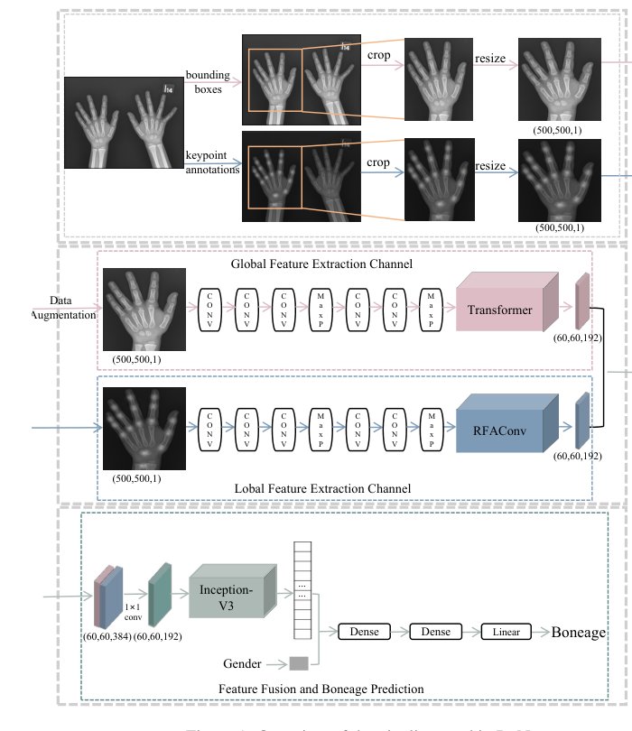 A two-stream network with global-local feature fusion for bone age assessment Figure 1
