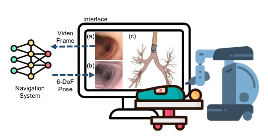 BREATH-VL: Vision-Language-Guided 6-DoF Bronchoscopy Localization via Semantic-Geometric Fusion Figure 1