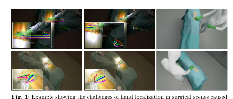 A Multi-View Pipeline and Benchmark Dataset for 3D Hand Pose Estimation in Surgery Figure 1
