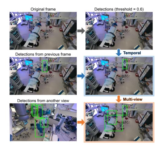 Self-Supervised Uncalibrated Multi-View Video Anonymization in the Operating Room Figure 1