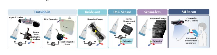 MLRecon: Robust Markerless Freehand 3D Ultrasound Reconstruction via Coarse-to-Fine Pose Estimation Figure 1