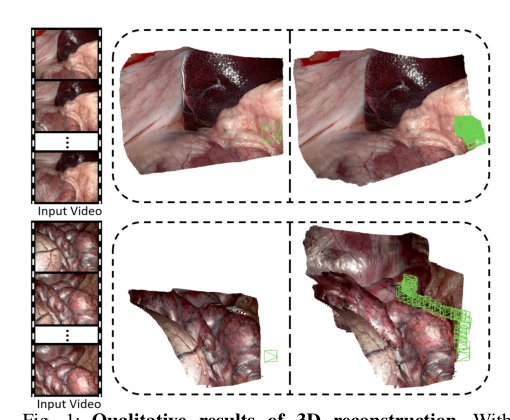 SurgCUT3R: Surgical Scene-Aware Continuous Understanding of Temporal 3D Representation Figure 1
