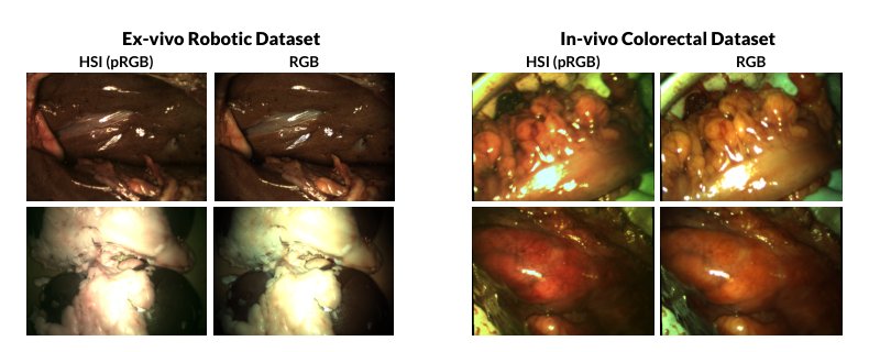 HyKey: Hyperspectral Keypoint Detection and Matching in Minimally Invasive Surgery Figure 1
