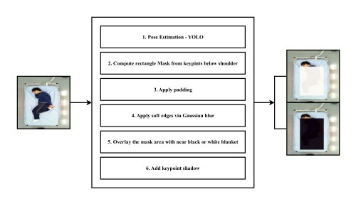 Geometry-Conditioned Diffusion for Occlusion-Robust In-Bed Pose Estimation Figure 1