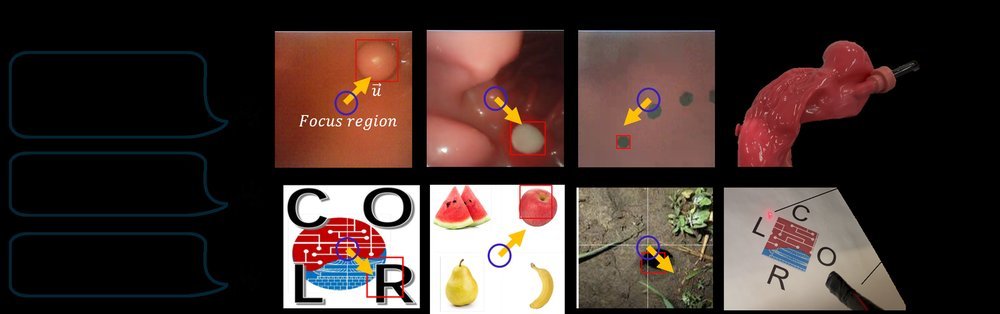EndoVLA: Dual-Phase Vision-Language-Action for Precise Autonomous Tracking in Endoscopy figure