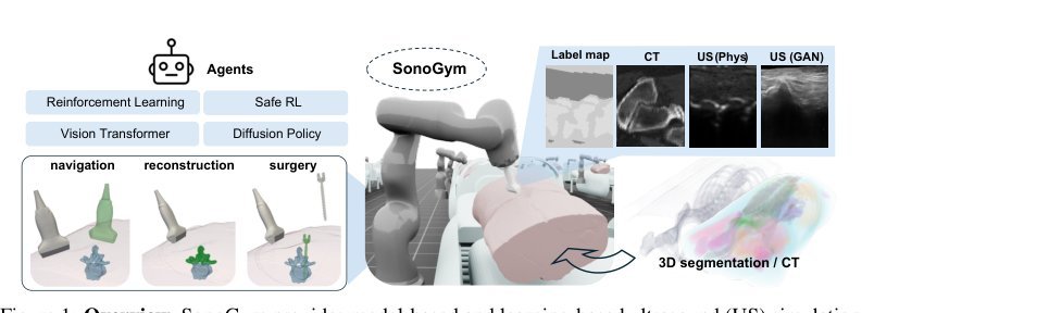 SonoGym: High Performance Simulation for Challenging Surgical Tasks with Robotic Ultrasound figure