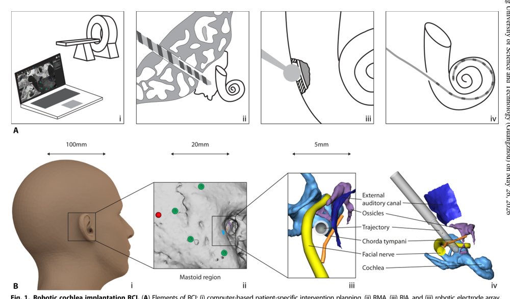 Instrument flight to the inner ear Figure 1
