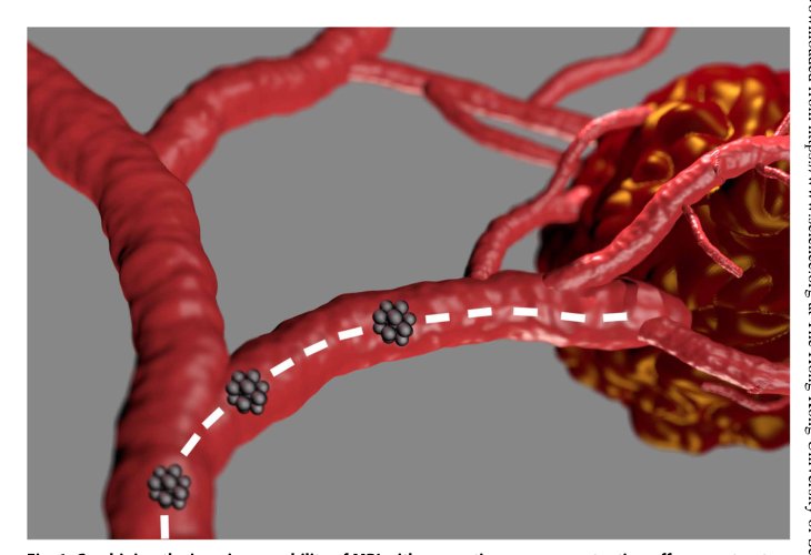 Beyond imaging: Macro- and microscale medical robots actuated by clinical MRI scanners Figure 1