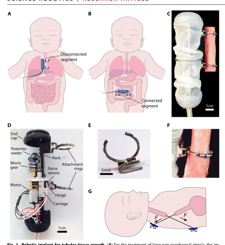 In vivo tissue regeneration with robotic implants Figure 1