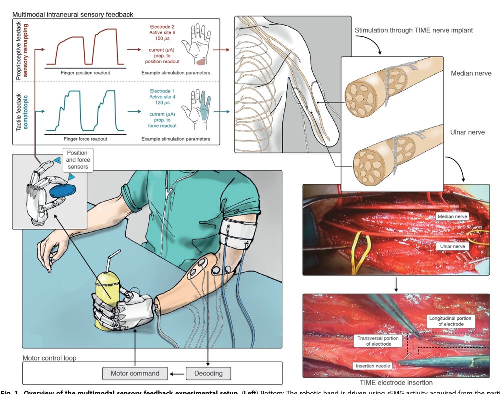 A closed-loop hand prosthesis with simultaneous intraneural tactile and position feedback Figure 1