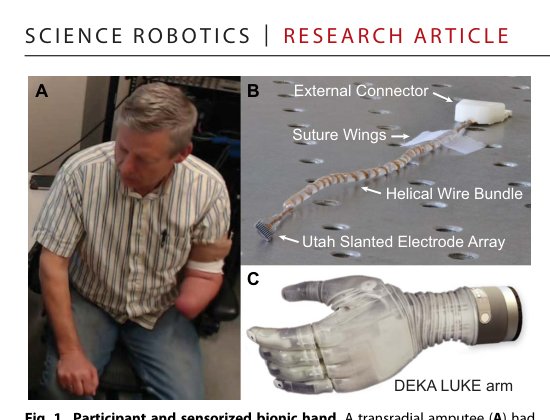 Biomimetic sensory feedback through peripheral nerve stimulation improves dexterous use of a bionic hand Figure 1