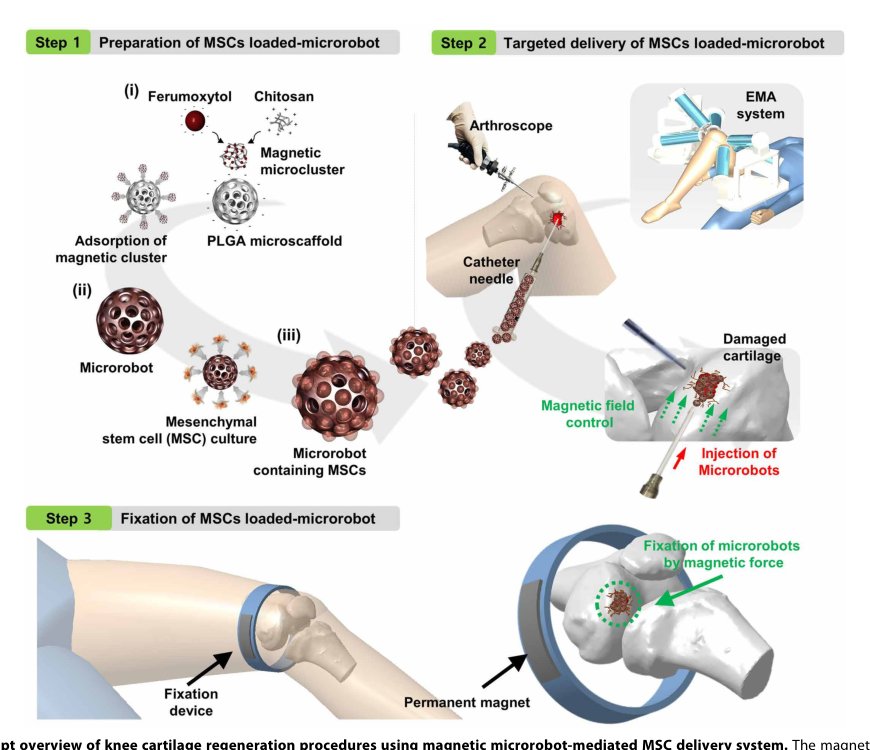 Human adipose–derived mesenchymal stem cell–based medical microrobot system for knee cartilage regeneration in vivo Figure 1