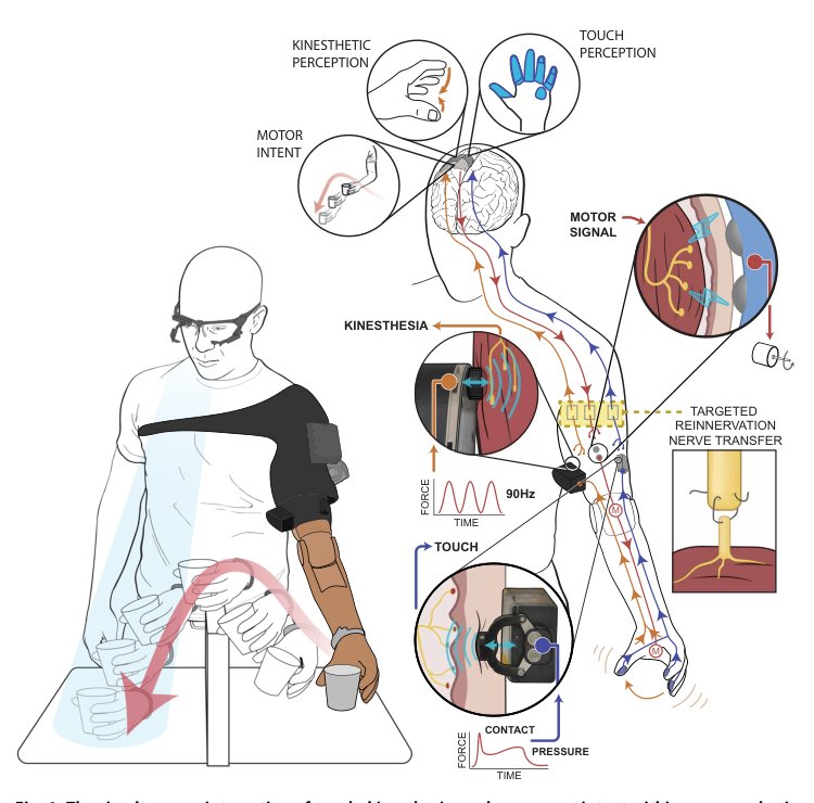 Neurorobotic fusion of prosthetic touch, kinesthesia, and movement in bionic upper limbs promotes intrinsic brain behaviors Figure 1