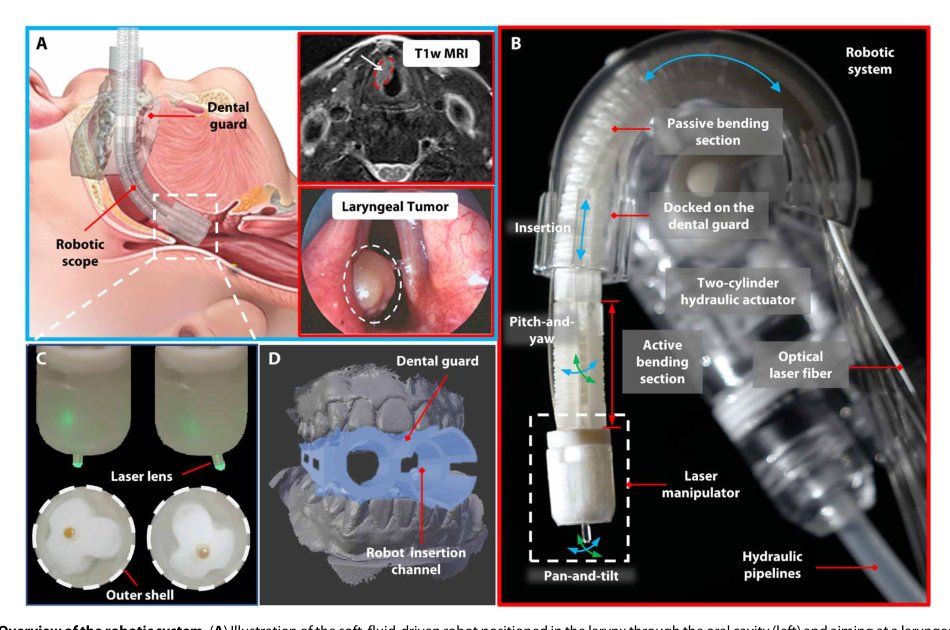 Soft robotic manipulator for intraoperative MRI-guided transoral laser microsurgery Figure 1
