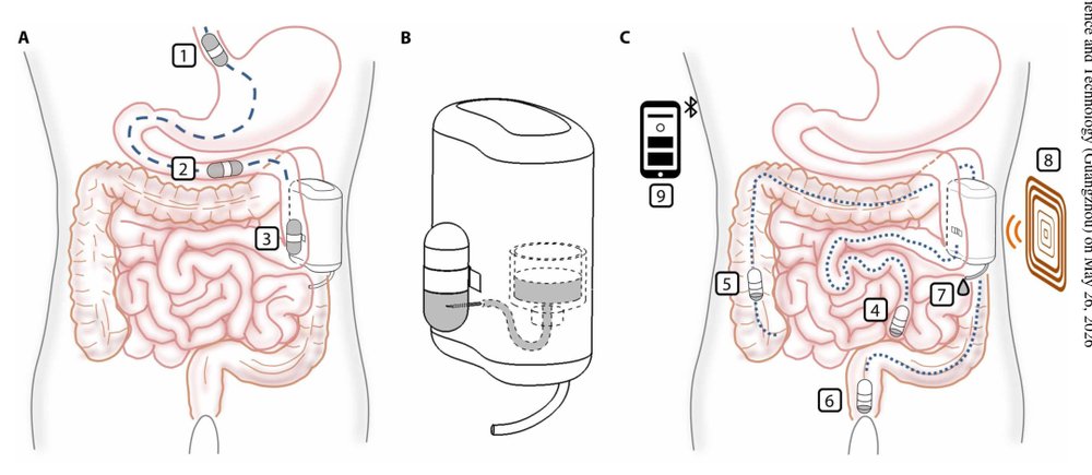 A fully implantable device for intraperitoneal drug delivery refilled by ingestible capsules Figure 1