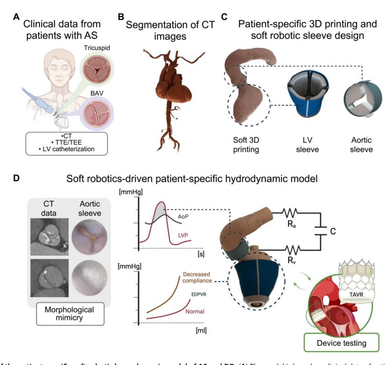 Soft robotic patient-specific hydrodynamic model of aortic stenosis and ventricular remodeling Figure 1