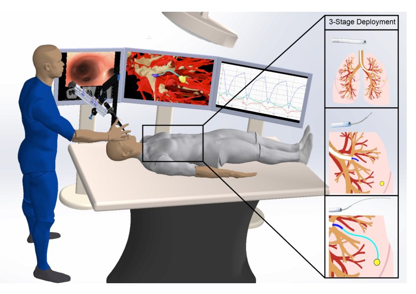 Autonomous medical needle steering in vivo Figure 1
