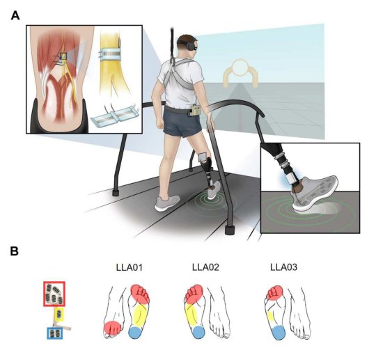 Plantar somatosensory restoration enhances gait, speed perception, and motor adaptation Figure 1