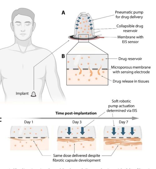 Robotic self-modulation enhances implantable long-acting drug delivery devices Figure 1