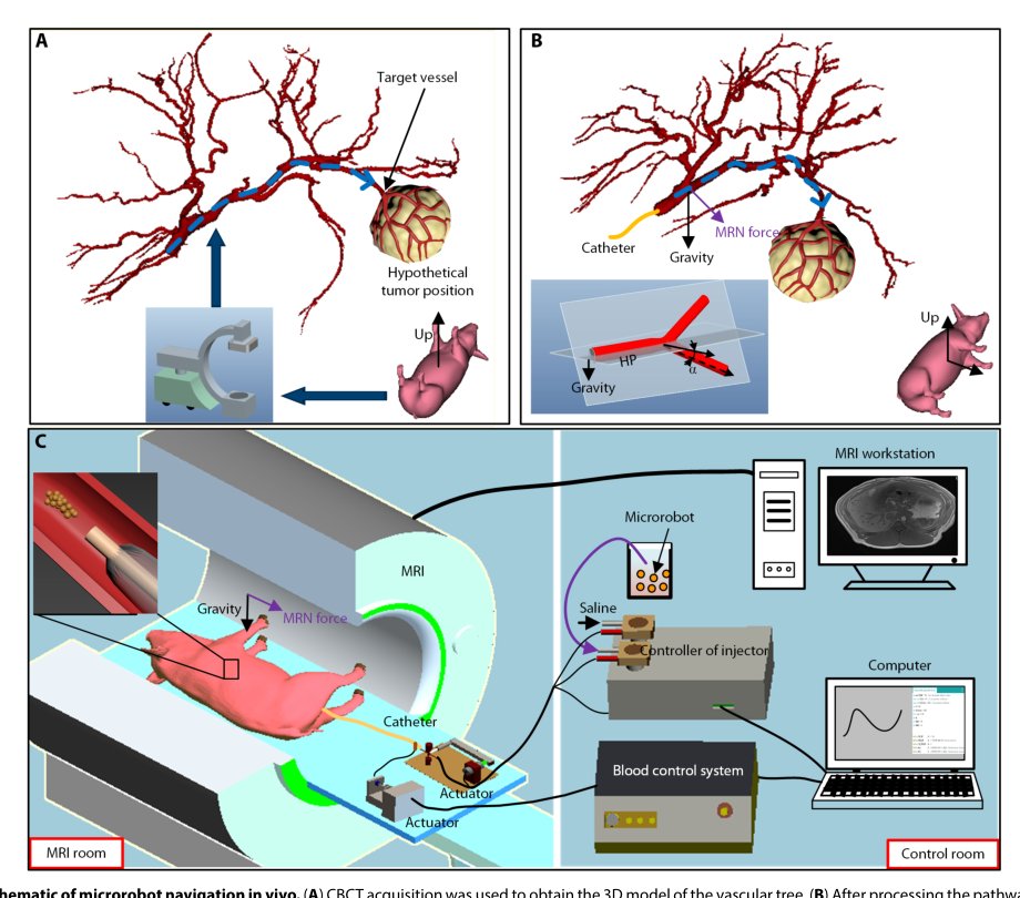 Human-scale navigation of magnetic microrobots in hepatic arteries Figure 1