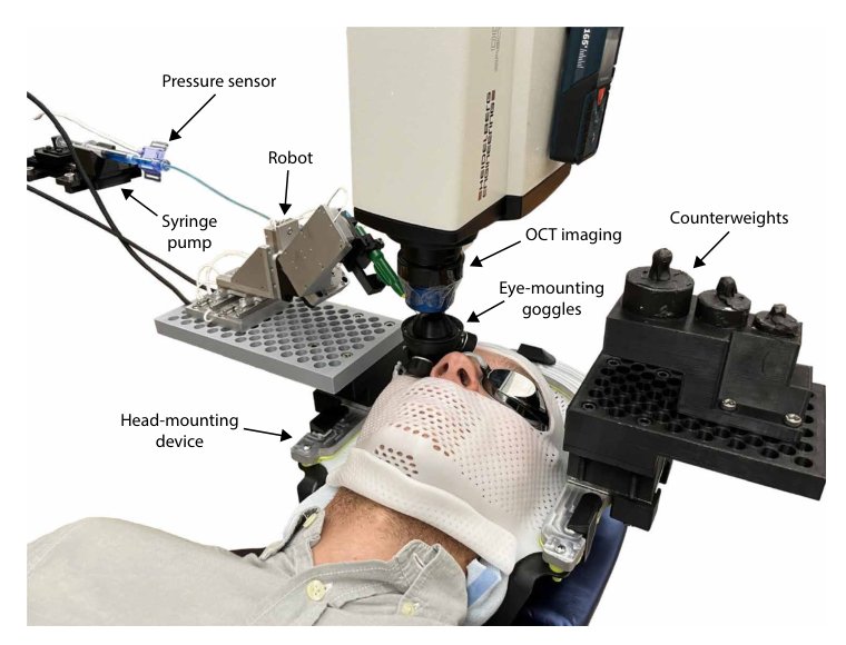 Head-mounted surgical robots are an enabling technology for subretinal injections Figure 1
