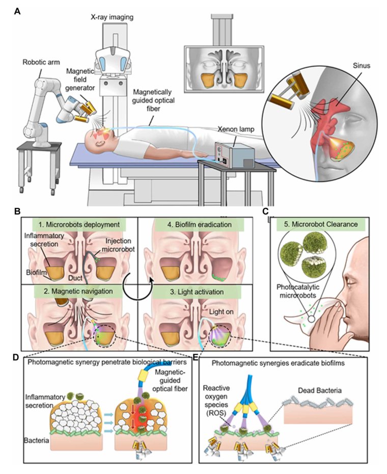 Photocatalytic microrobots for treating bacterial infections deep within sinuses Figure 1