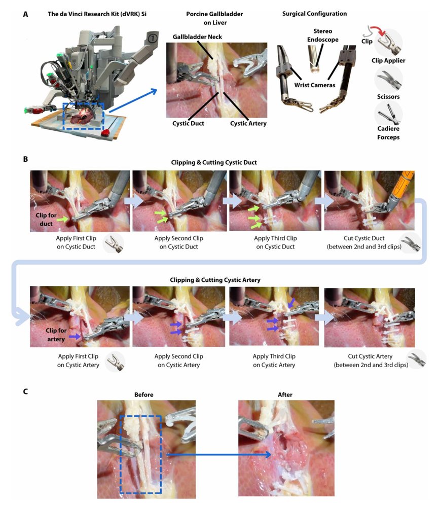 SRT-H: A hierarchical framework for autonomous surgery via language-conditioned imitation learning Figure 1