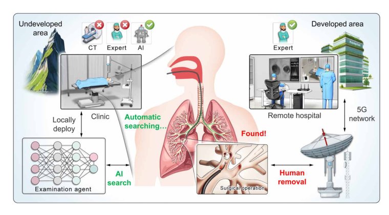 AI search, physician removal: Bronchoscopy robot bridges collaboration in foreign body aspiration Figure 1