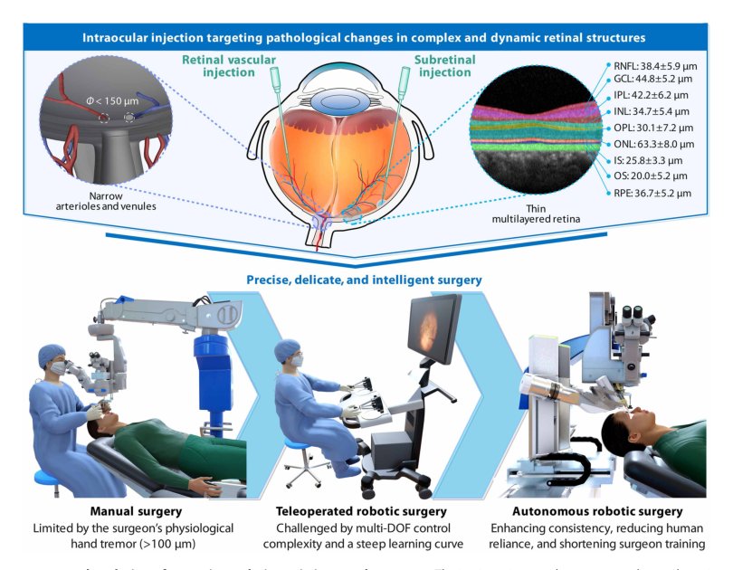 Autonomous robotic intraocular surgery for targeted retinal injections Figure 1