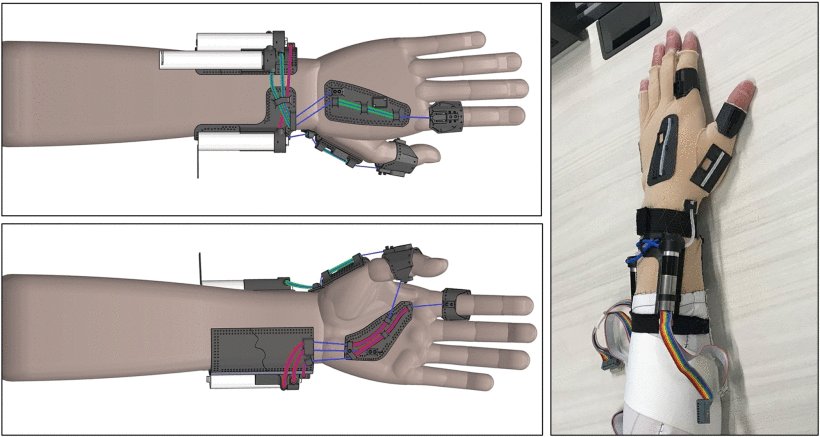 Comprehensive Kinematic Model of a Tendon-Driven Wearable Tremor Suppression Device Figure 1