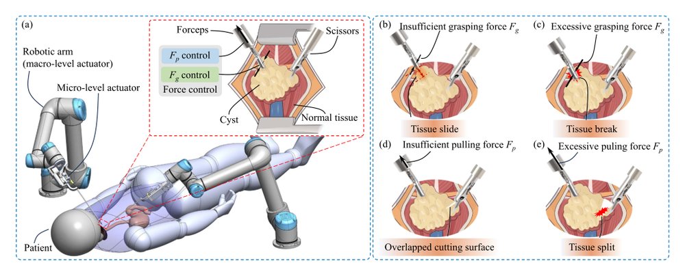 Automatic Tissue Traction Using Miniature Force-Sensing Forceps for Minimally Invasive Surgery Figure 1